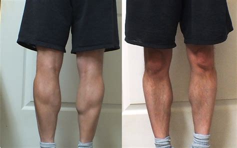 cyclist legs before and after.